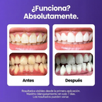 Purple Whitening Strips